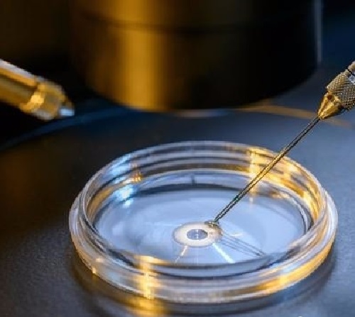 三代試管嬰兒分別有什么不同？