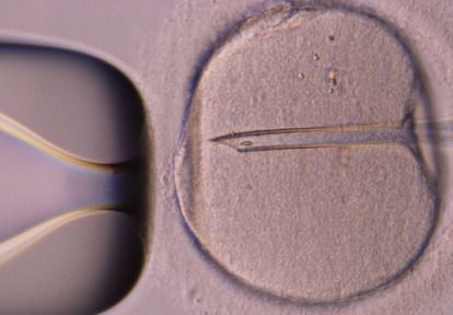 做試管嬰兒如何選擇正確的機構(gòu)？