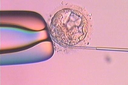 促排取卵會(huì)不會(huì)痛？對(duì)身體有沒有影響？