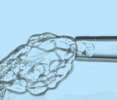 備孕試管嬰兒，需要準(zhǔn)備哪些？