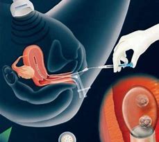 做一次試管嬰兒要用很長時間？