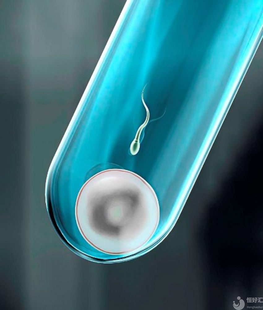 做試管嬰兒對精子質(zhì)量有什么要求？