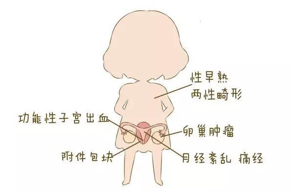 護理子宮，讓女性遠離婦科疾病