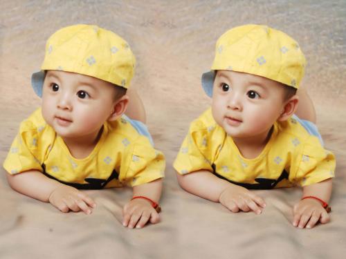 試管移植多胎還是單胎？哪個更好一點？