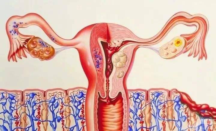 子宮內(nèi)膜增生，會(huì)影響懷孕嗎？