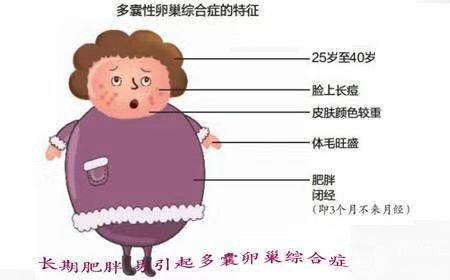 肥胖最招惹婦科疾病，你知道嗎？