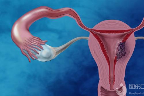 子宮內(nèi)膜薄能否做試管治療？要怎么辦？