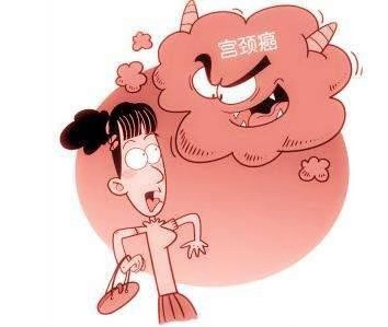 不用檢查也能知道是宮頸癌，看哪些癥狀？