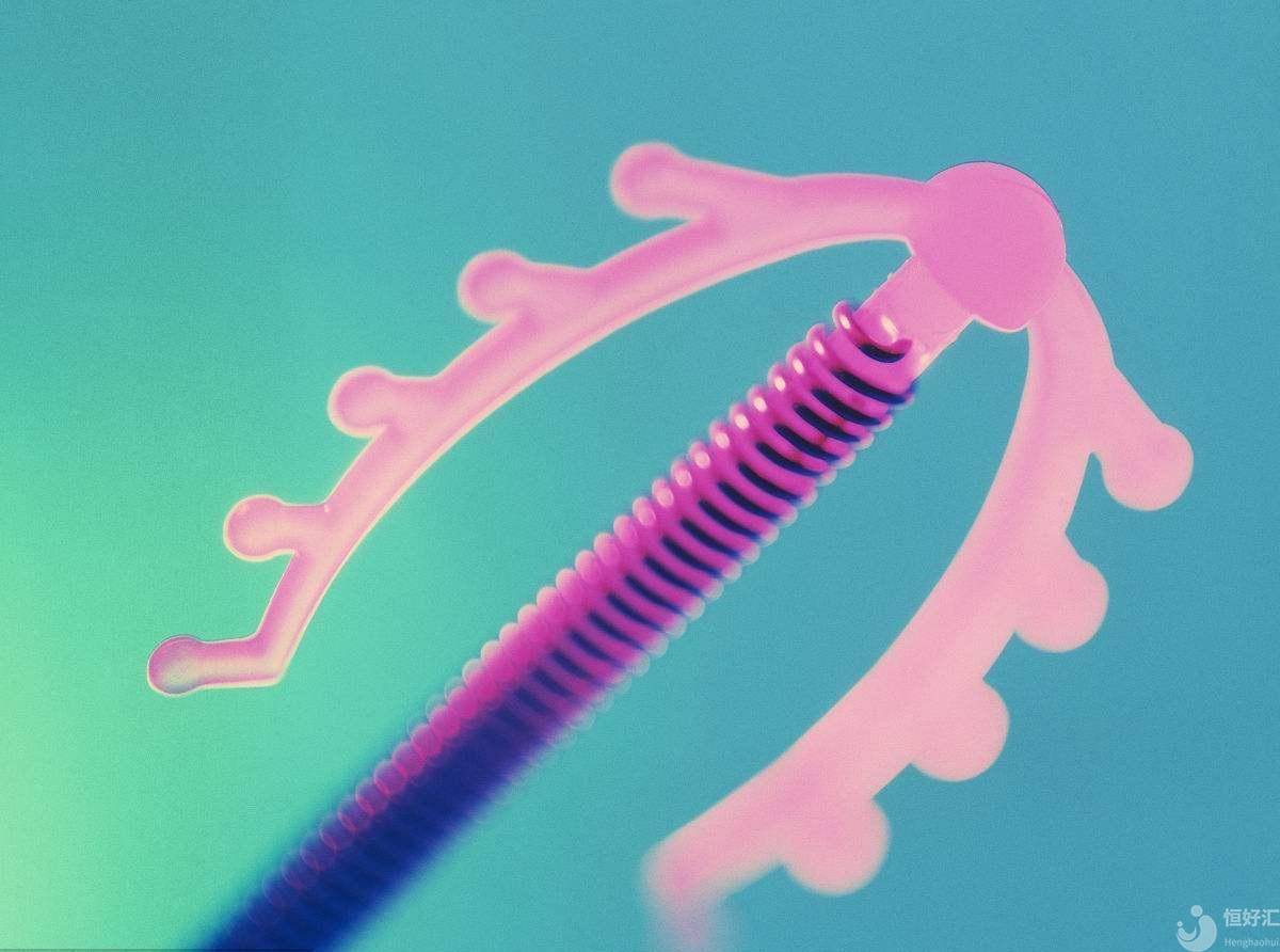 治療子宮內(nèi)膜異位癥，曼月樂環(huán)管用嗎？