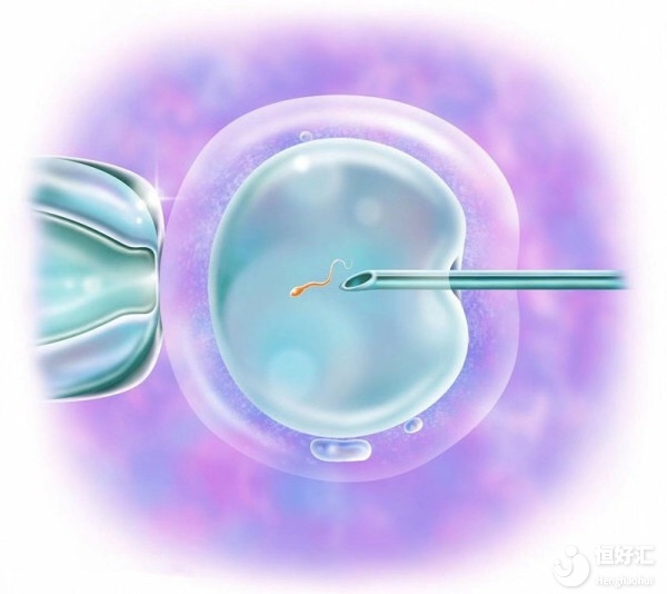 第二代試管技術的成功率高嗎？