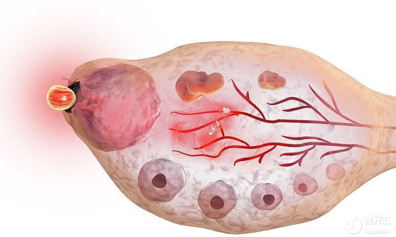 卵巢功能減退，是誰的錯(cuò)？