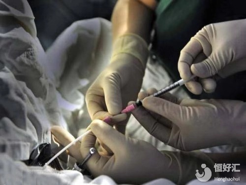 取卵過后，卵巢多久能恢復(fù)？