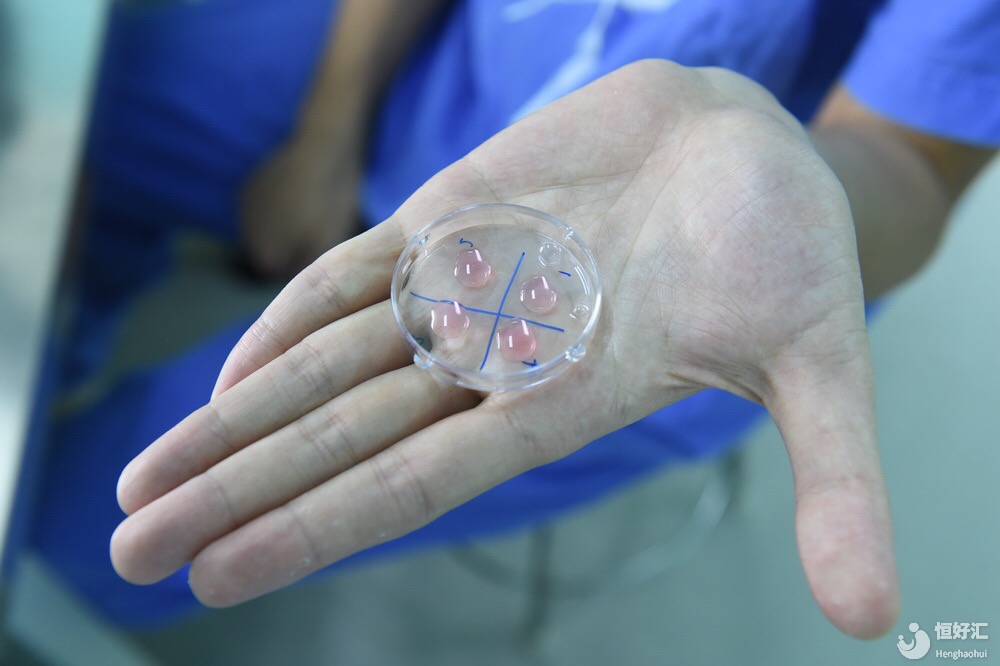 試管促排時，如何預(yù)測卵子的數(shù)量和質(zhì)量呢？