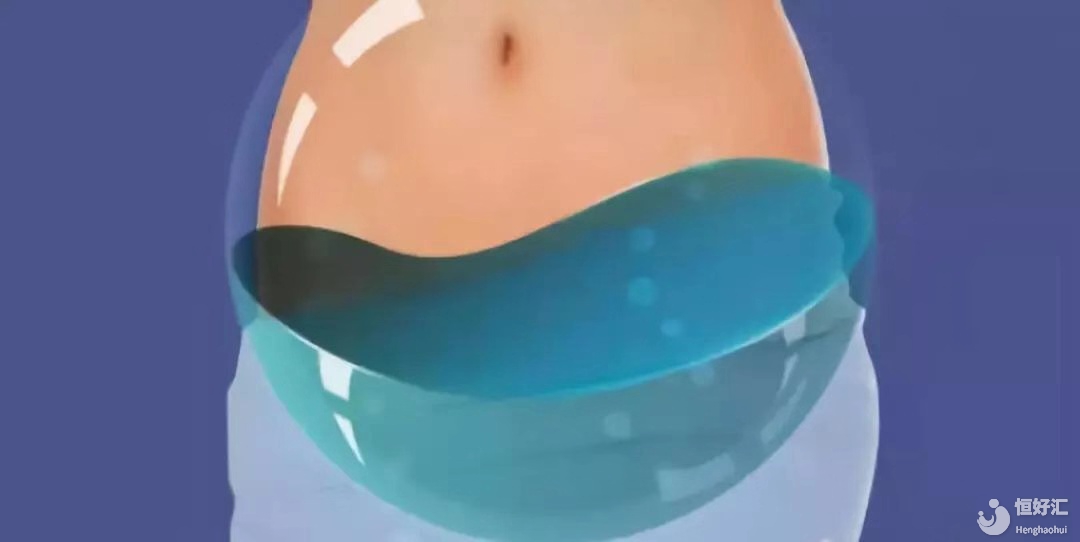 盆腔積液會對試管嬰兒有影響，你了解嗎？