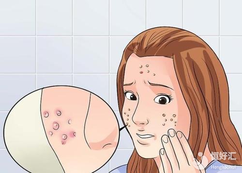 懷孕期間還能繼續(xù)用護(hù)膚品嗎？