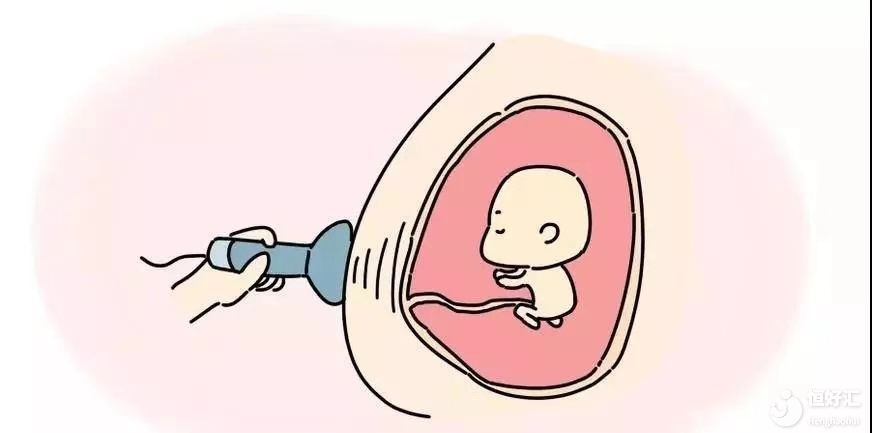 為什么要做NT檢查，有什么好處嗎？