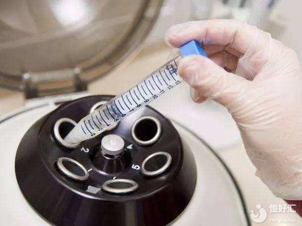 疑惑解答：什么是洗精術(shù)？洗精術(shù)的作用是什么？