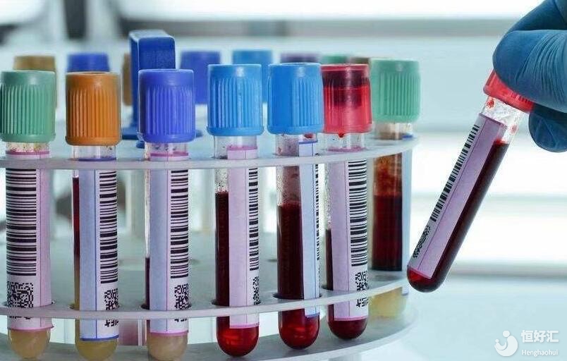 做試管嬰兒時抽血檢查時有什么注意事項呢？