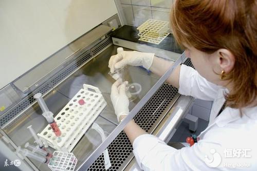 男性的孕前檢查項(xiàng)目有哪些？主要有這4項(xiàng)