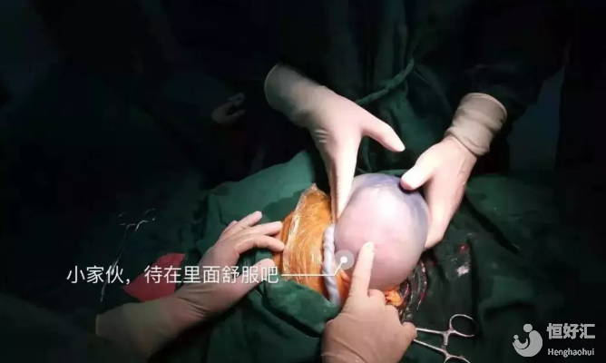 36歲孕婦產(chǎn)下“透明蛋”！難道人類物種發(fā)生了變異？