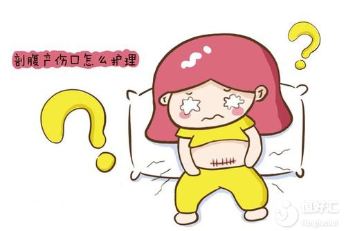 剖腹產(chǎn)的這些好處，孕媽盡量別忽視！