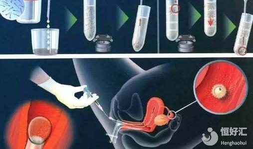 聽說人工授精的成功率非常低，這是真的嗎？