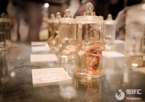 女性過瘦，做俄羅斯試管嬰兒的成功率會怎么樣？