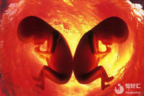 夫妻雙方做好這幾點，懷雙胞胎再也不是夢！