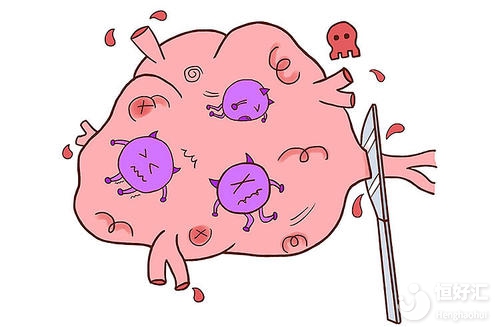 答疑解惑：怎樣才算是子宮內(nèi)膜增生？如何診斷內(nèi)膜增生？