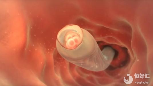 做泰國試管嬰兒會不會很痛苦？聽醫(yī)生這樣說……