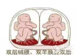 試管嬰兒懷雙胞胎有風(fēng)險(xiǎn)，你需做好這幾點(diǎn)