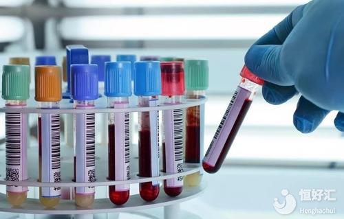 試管嬰兒各個階段抽血檢查你知道是怎么回事嗎？
