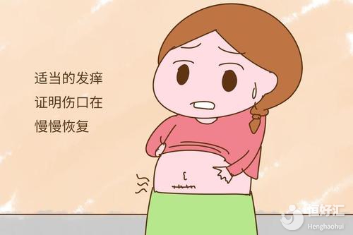 剖腹產(chǎn)孕媽注意了！產(chǎn)后這樣護理助你快速恢復