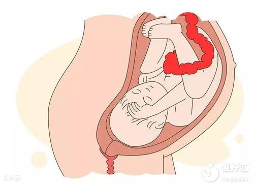 胎兒遲遲不入盆不知所措？或許你可以這樣做