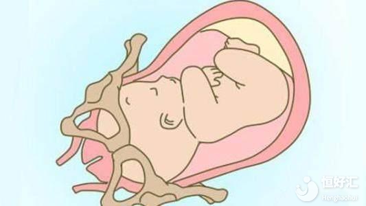 胎兒入盆會(huì)有感覺(jué)嗎？這幾點(diǎn)也許你想不到