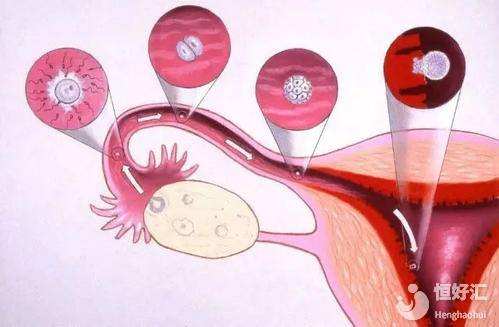 子宮內膜對試管嬰兒有什么影響？看完才知道