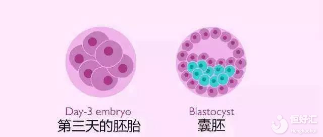 做試管嬰兒很難成功？試管養(yǎng)囊成功率請(qǐng)收藏！