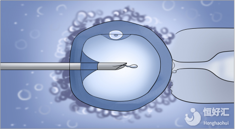 關(guān)于試管長(zhǎng)方案那些事兒，花3分鐘就能了解！