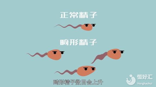 精子畸形率高還可以做試管嬰兒嗎？其真相很意外