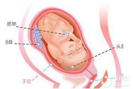 胎兒入盆有什么感覺？這些感覺很多人都有