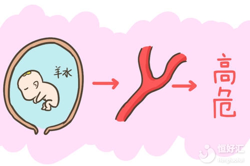 為什么醫(yī)生會害怕產婦咳嗽？其原因不敢相信