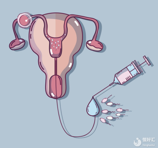 卵巢早衰不等人，做試管要趁早！