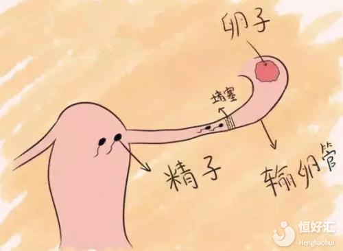 沒有輸卵管還能做試管嬰兒嗎？這一點(diǎn)很關(guān)鍵