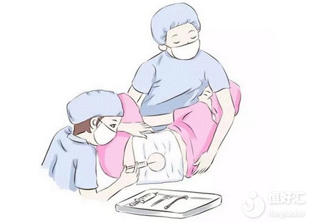 哪種分娩方式比較好？醫(yī)生勸你早點(diǎn)做決定