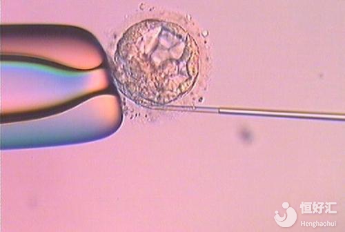 試管嬰兒長(zhǎng)方案成功率高嗎？看完才知道不容易