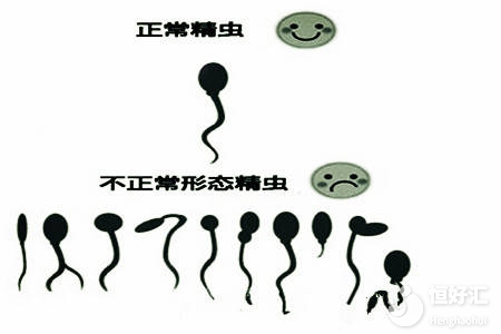 精子頭部畸形？醫(yī)生：這幾點原因脫不了干系