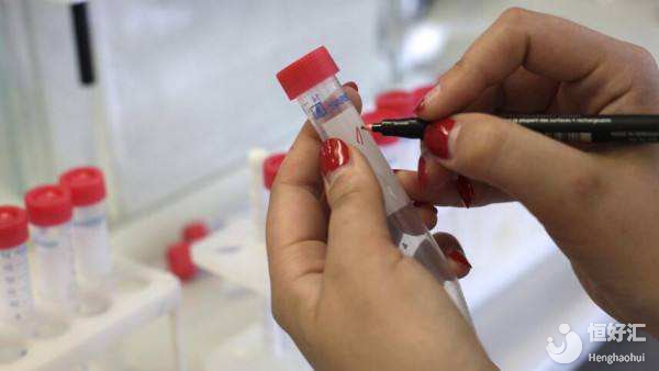 試管知識(shí)之準(zhǔn)爸爸取精期間哪些必須要注意？