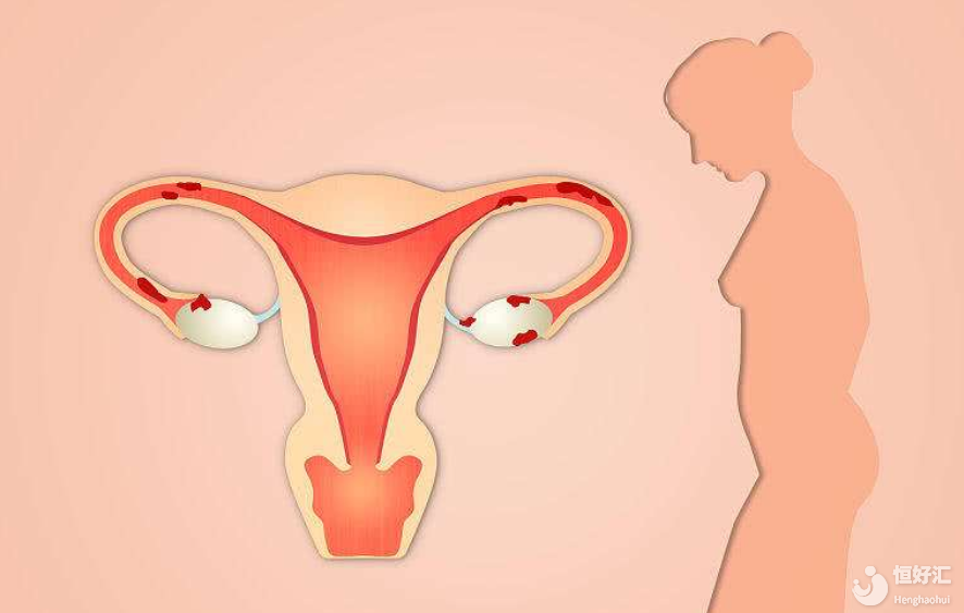 一側(cè)的輸卵管堵塞了還可以懷孕嗎？輸卵管堵塞如何預(yù)防？