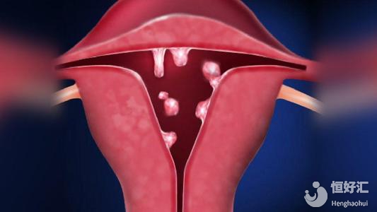 孕育揭秘：子宮環(huán)境對試管嬰兒成功率有影響嗎？