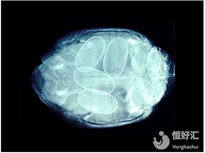 關(guān)于試管嬰兒冷凍卵子那些事兒，說(shuō)出來(lái)很驚訝！